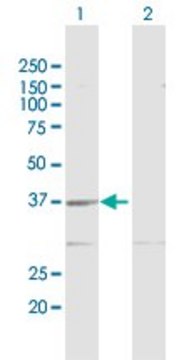 Anti-GMPR2 antibody produced in rabbit