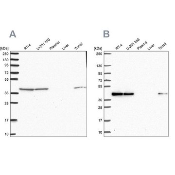 Anti-IDH3B antibody produced in rabbit