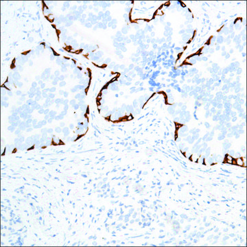 Anti-Keratin 17 antibody, Rabbit monoclonal