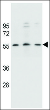 ANTI-KCNK18 (CENTER) antibody produced in