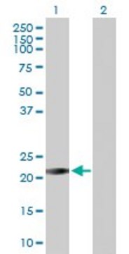 Anti-RAB26 antibody produced in rabbit