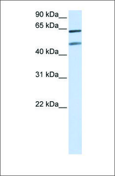 Anti-OPTN (ab2) antibody produced in
