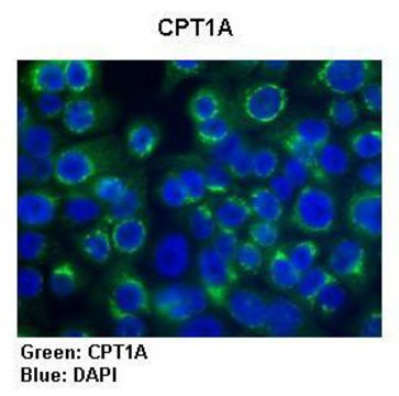 Anti-CPT1A antibody produced in rabbit