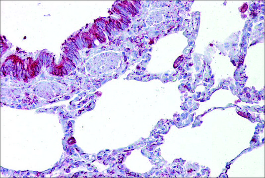 Anti-GABRB3 antibody produced in rabbit