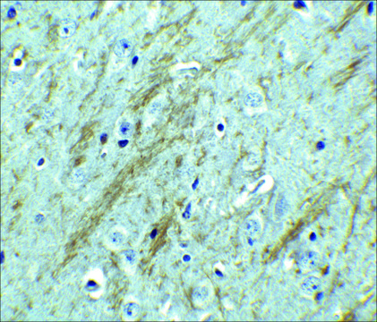 Anti-BACE antibody produced in rabbit