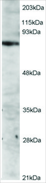 Anti-ITK antibody produced in goat