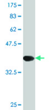 Monoclonal Anti-TAC3, (C-terminal) antibody produced