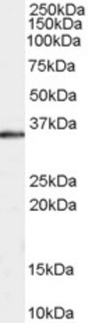 Anti-RAD51AP1 (C-terminal) antibody produced in
