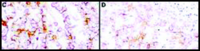 Monoclonal Anti-Mesothelin antibody produced in