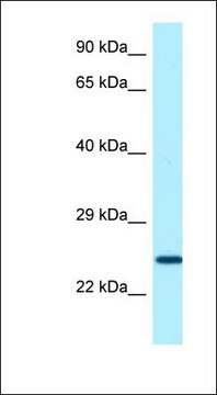 Anti-SOSTDC1 antibody produced in rabbit
