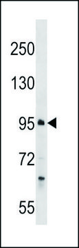 ANTI-PROSER1 (N-TERM) antibody produced in