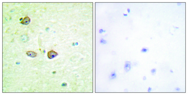 Anti-5-HT-1B antibody produced in rabbit