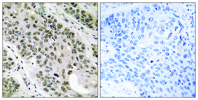 Anti-TNNI3K antibody produced in rabbit