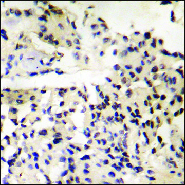 Anti-phospho-MDM4 (pSer³??) antibody produced in