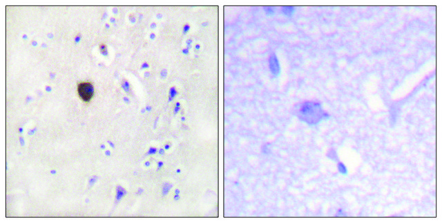 Anti-KIR6.2 antibody produced in rabbit