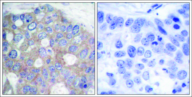 Anti-RPS6KB1 (Ab-421) antibody produced in