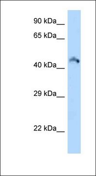 Anti-RIMKLB antibody produced in rabbit