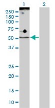 Anti-ADPGK antibody produced in rabbit