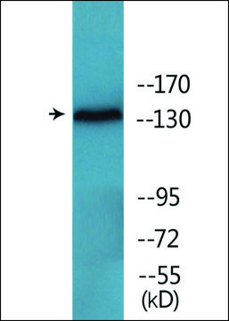 Anti-phospho-EGFR (pTyr¹¹?²) antibody produced in