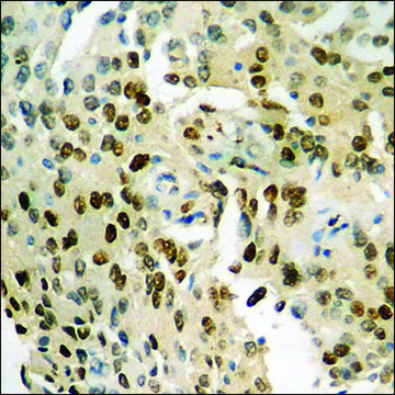 Anti-phospho-NF-kappaB p65 (pSer²??) antibody produced