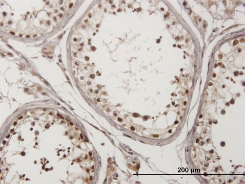Monoclonal Anti-CHEK2 antibody produced in