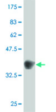 ANTI-GUCY2C antibody produced in mouse