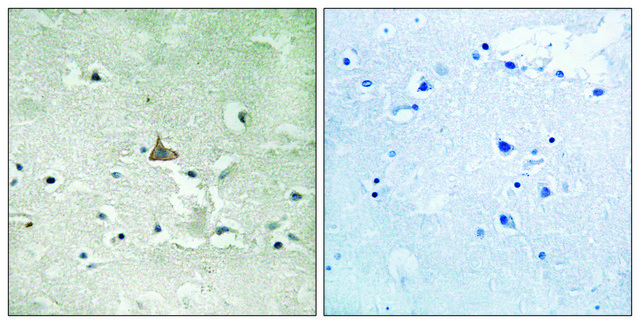Anti-phospho-Trk B (pTyr706/Tyr707) antibody produced