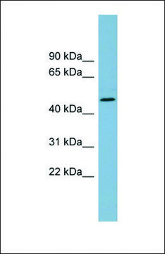 Anti-TDO2, (N-terminal) antibody produced in