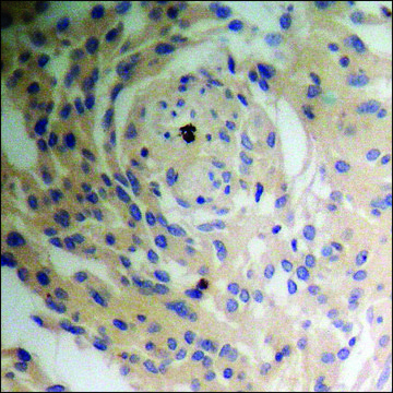 Anti-phospho-Tuberin/TSC2 (pSer?³?) antibody produced in