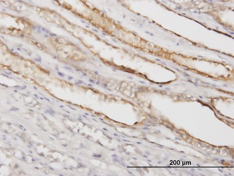 Monoclonal Anti-PGGT1B antibody produced in