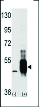 ANTI-COT (MAP3K8/MEKK8)(C-TERMINAL) antibody produced in