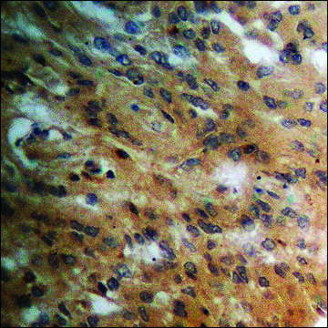 Anti-phospho-PPAR-? (pSer¹¹²) antibody produced in