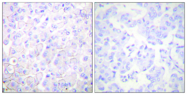 Anti-Cadherin-pan antibody produced in rabbit