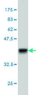 Monoclonal Anti-GRK4 antibody produced in