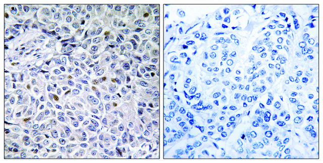 Anti-ZAP-70 antibody produced in rabbit