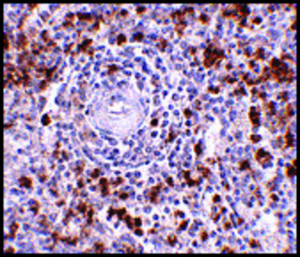 Anti-EBI3 (ab1) antibody produced in