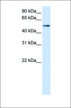 Anti-USP22 (ab2) antibody produced in