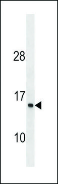 ANTI-ATP6V1G1 (C-TERM) antibody produced in