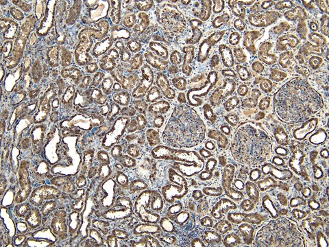 Anti-EWS/EWSR1 antibody produced in goat