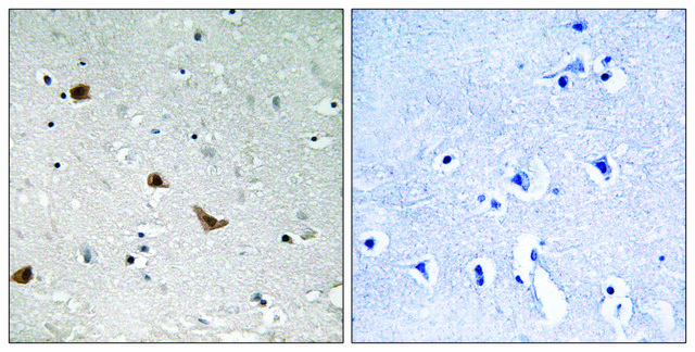Anti-phospho-IKK-? (pSer³??) antibody produced in