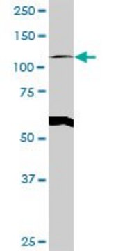 Anti-GART antibody produced in rabbit