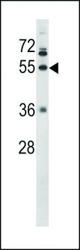 ANTI-FIBG(C-TERMINAL) antibody produced in rabbit