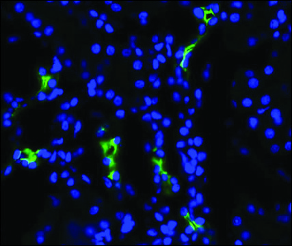 Anti-AQP2 antibody produced in rabbit