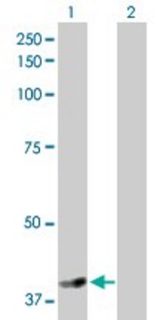 Anti-NSDHL antibody produced in rabbit