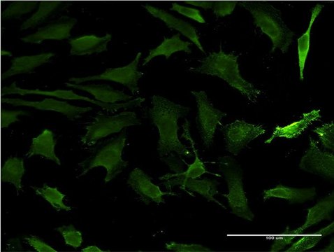 ANTI-HD antibody produced in mouse