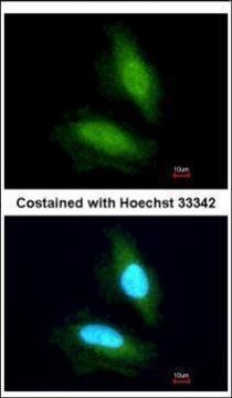 Anti-NPEPPS antibody produced in rabbit