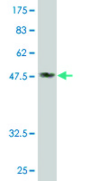 Monoclonal Anti-DDAH2 antibody produced in