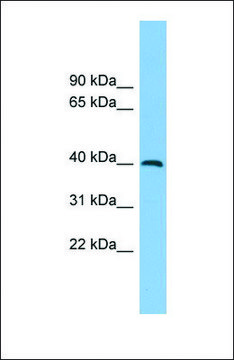 Anti-ADH5 antibody produced in rabbit