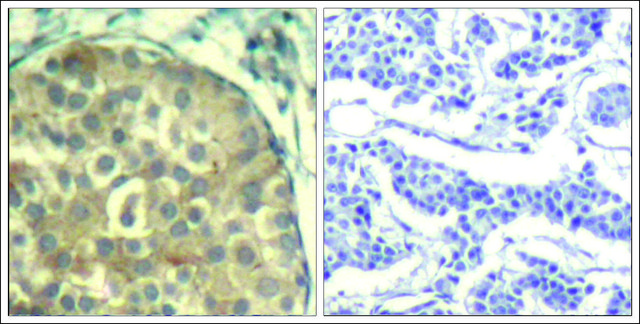 Anti-phospho-CFL1/CFL2 (pTyr??) antibody produced in