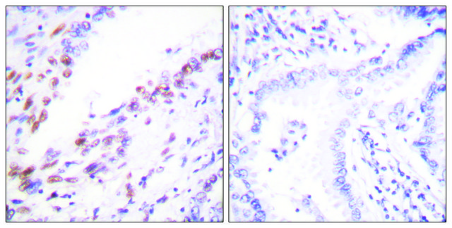 Anti-KI67 antibody produced in rabbit